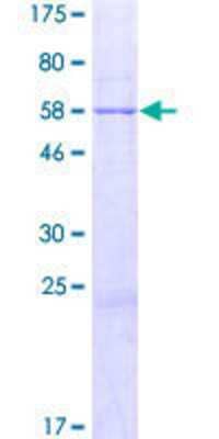 SDS-PAGE: Recombinant Human ABHD11 GST (N-Term) Protein [H00083451-P01]