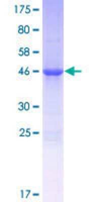 SDS-PAGE: Recombinant Human ALKBH7 GST (N-Term) Protein [H00084266-P01]