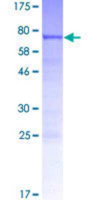 SDS-PAGE: Recombinant Human SKAR GST (N-Term) Protein [H00084271-P01]