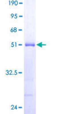 SDS-PAGE: Recombinant Human DYDC2 GST (N-Term) Protein [H00084332-P01]