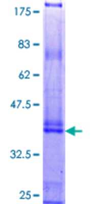 SDS-PAGE: Recombinant Human KRTAP4-4 GST (N-Term) Protein [H00084616-P01]