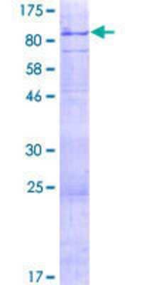 SDS-PAGE: Recombinant Human Connexin 62/GJA10 GST (N-Term) Protein [H00084694-P01]