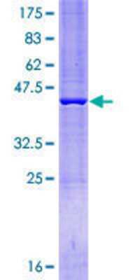 SDS-PAGE: Recombinant Human ZNF607 GST (N-Term) Protein [H00084775-P01]