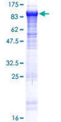 SDS-PAGE: Recombinant Human KLHL22 GST (N-Term) Protein [H00084861-P01]