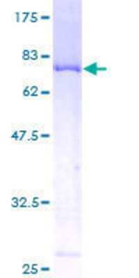 SDS-PAGE: Recombinant Human Tensin 4/CTEN GST (N-Term) Protein [H00084951-P01]