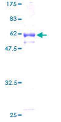 SDS-PAGE: Recombinant Human NKD2 GST (N-Term) Protein [H00085409-P01]