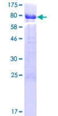 SDS-PAGE: Recombinant Human CABS1 GST (N-Term) Protein [H00085438-P01]