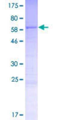 SDS-PAGE: Recombinant Human CCDC74B GST (N-Term) Protein [H00091409-P01]