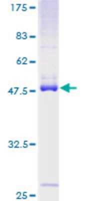 SDS-PAGE: Recombinant Human RASL10B GST (N-Term) Protein [H00091608-P01]