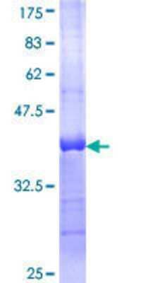 SDS-PAGE: Recombinant Human hCG beta 7 GST (N-Term) Protein [H00094027-Q01]