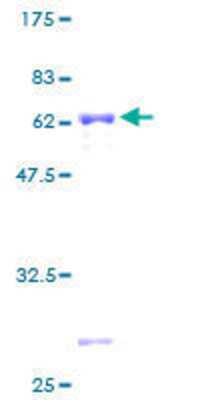 SDS-PAGE: Recombinant Human ZNF101 GST (N-Term) Protein [H00094039-P01]