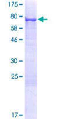 SDS-PAGE: Recombinant Human Cytokeratin 71 GST (N-Term) Protein [H00112802-P01]