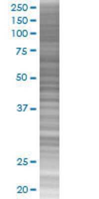 Other: ZNF257 293T Cell Transient Overexpression Lysate [H00113835-T01]