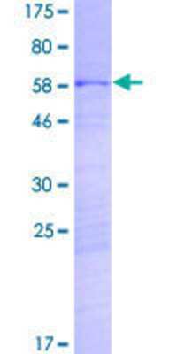 SDS-PAGE: Recombinant Human CROCCL2 GST (N-Term) Protein [H00114819-P01]