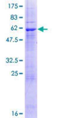 SDS-PAGE: Recombinant Human ZPBP2 GST (N-Term) Protein [H00124626-P01]