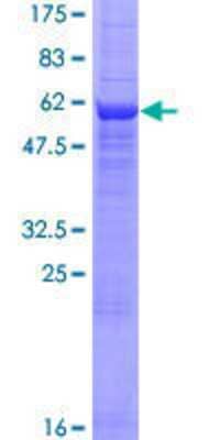 SDS-PAGE: Recombinant Human CNTD GST (N-Term) Protein [H00124817-P01]