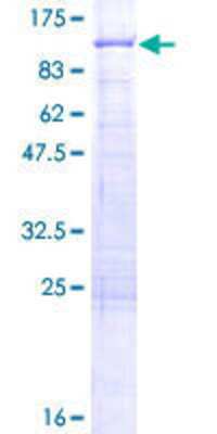 SDS-PAGE: Recombinant Human ALDH16A1 GST (N-Term) Protein [H00126133-P01]