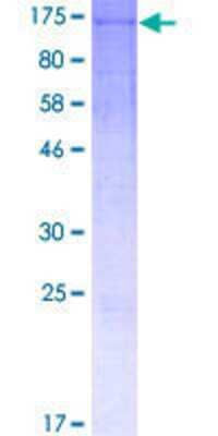 SDS-PAGE: Recombinant Human WDR63 GST (N-Term) Protein [H00126820-P01]