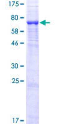 SDS-PAGE: Recombinant Human UGT3A1 GST (N-Term) Protein [H00133688-P01]