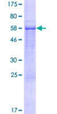 SDS-PAGE: Recombinant Human CAC1 GST (N-Term) Protein [H00143384-P01]