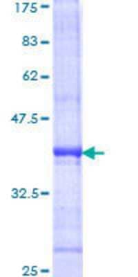 SDS-PAGE: Recombinant Human TRIF/TICAM1 GST (N-Term) Protein [H00148022-Q01]