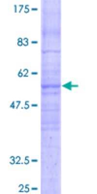 SDS-PAGE: Recombinant Human Cklfsf8 GST (N-Term) Protein [H00152189-P01]