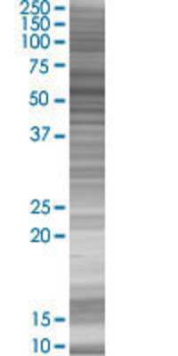 Other: SASS6 293T Cell Transient Overexpression Lysate [H00163786-T01]