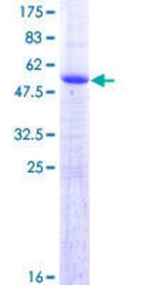 SDS-PAGE: Recombinant Human FAM9C GST (N-Term) Protein [H00171484-P01]