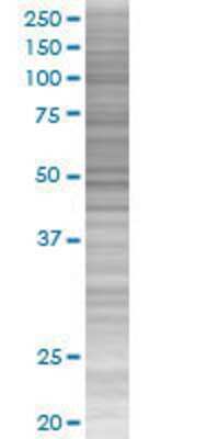 Other: MLKL 293T Cell Transient Overexpression Lysate [H00197259-T01]