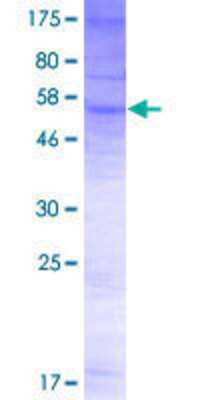 SDS-PAGE: Recombinant Human OSTalpha GST (N-Term) Protein [H00200931-P01]