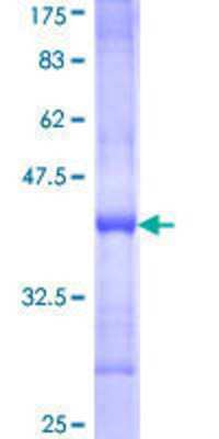 SDS-PAGE: Recombinant Human NRK GST (N-Term) Protein [H00203447-Q01]