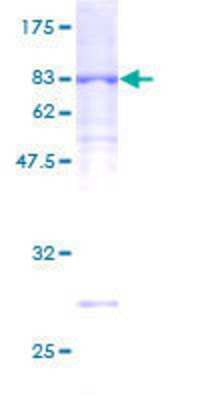 SDS-PAGE: Recombinant Human UNC5CL GST (N-Term) Protein [H00222643-P01]