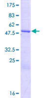 SDS-PAGE: Recombinant Human ZNF192P2 GST (N-Term) Protein [H00222701-P01]