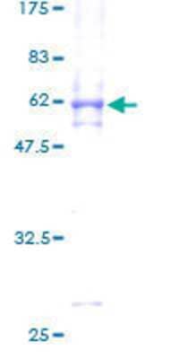 SDS-PAGE: Recombinant Human MAPK15 GST (N-Term) Protein [H00225689-P01]