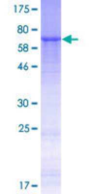 SDS-PAGE: Recombinant Human ADAM5P GST (N-Term) Protein [H00255926-P01]