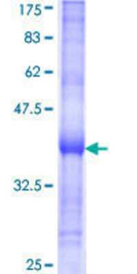 SDS-PAGE: Recombinant Human LOC283155 similar to ALK-3 GST (N-Term) Protein [H00283155-Q01]