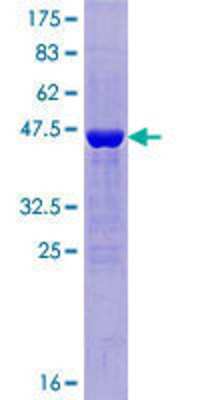 SDS-PAGE: Recombinant Human BOD1P GST (N-Term) Protein [H00284257-P01]