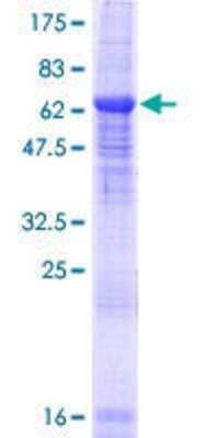 SDS-PAGE: Recombinant Human BTBD8 GST (N-Term) Protein [H00284697-P01]