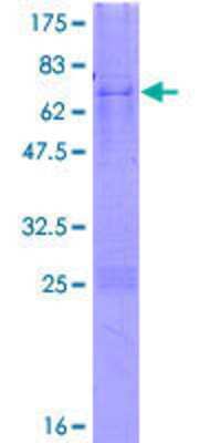 SDS-PAGE: Recombinant Human C3orf38 GST (N-Term) Protein [H00285237-P01]