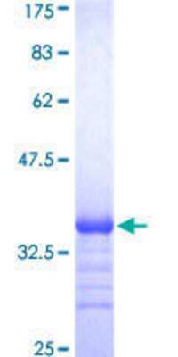 SDS-PAGE: Recombinant Human EMR4P GST (N-Term) Protein [H00326342-Q01]