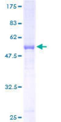 SDS-PAGE: Recombinant Human RAB37 GST (N-Term) Protein [H00326624-P01]