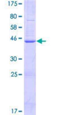 SDS-PAGE: Recombinant Human TMEM179B GST (N-Term) Protein [H00374395-P01]