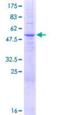 SDS-PAGE: Recombinant Human SLC25A35 GST (N-Term) Protein [H00399512-P01]