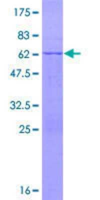 SDS-PAGE: Recombinant Human TRIM72 GST (N-Term) Protein [H00493829-P01]