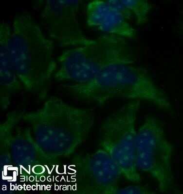 Immunocytochemistry/ Immunofluorescence: rRNA Antibody (Y10b) - Azide and BSA Free [NBP2-80932]