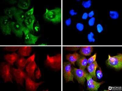 Immunocytochemistry/ Immunofluorescence: rRNA Antibody (Y10b) - Azide and BSA Free [NBP2-80932]