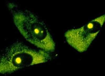 Immunocytochemistry/ Immunofluorescence: rRNA Antibody (Y10b) - Azide and BSA Free [NBP2-80932]