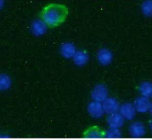 Fc gamma RII/CD32 Antibody (AT130-5) - (Cardiac)