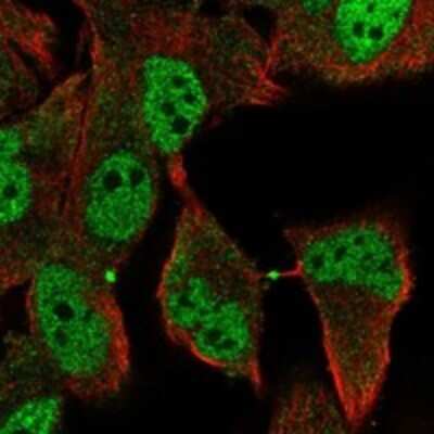 Immunocytochemistry/ Immunofluorescence: retinol dehydrogenase 8 (all trans) Antibody [NBP3-17534]