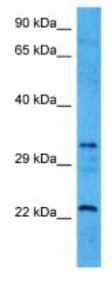 Western Blot: retinol dehydrogenase 8 (all trans) Antibody [NBP3-10040]